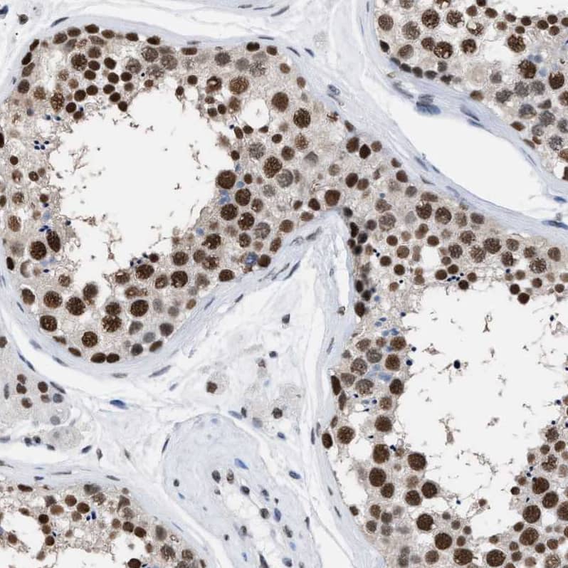 Immunohistochemistry-Paraffin DBC1/p30 Antibody