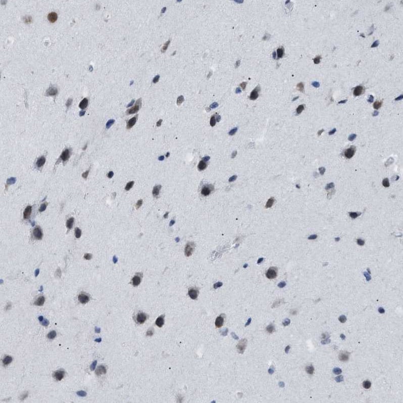 Immunohistochemistry-Paraffin DBC1/p30 Antibody