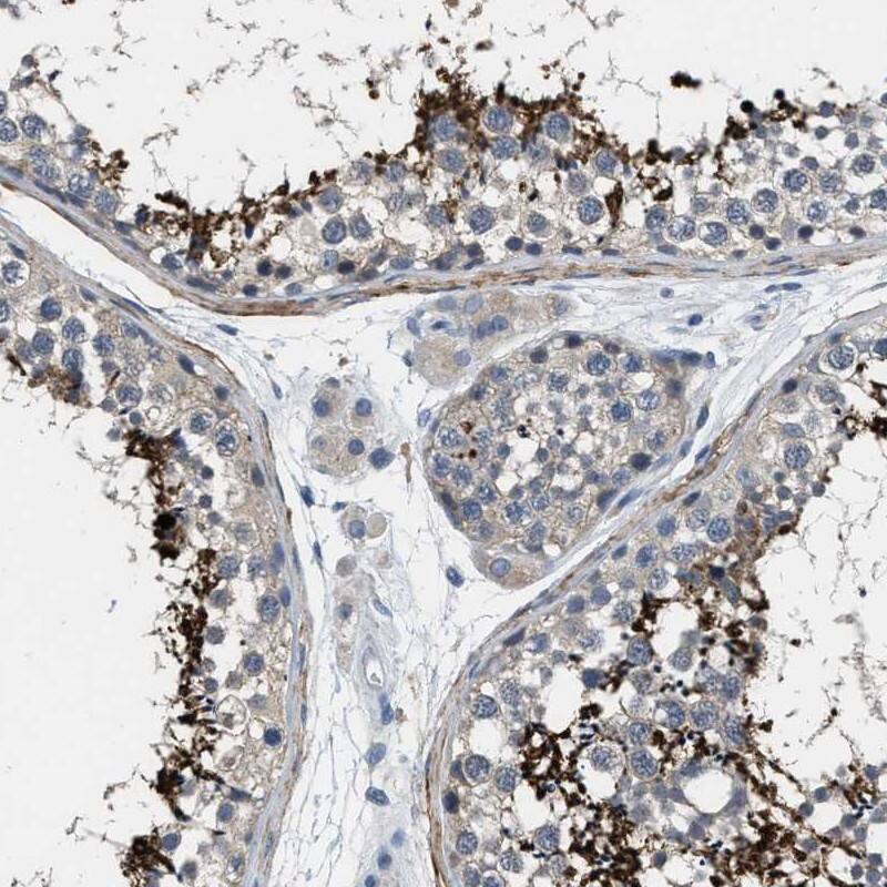 Staining of human testis shows distinct positivity in spermatids and spermatozoa.