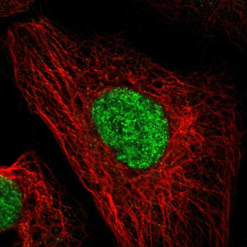 Immunocytochemistry/ Immunofluorescence DACH1 Antibody - BSA Free