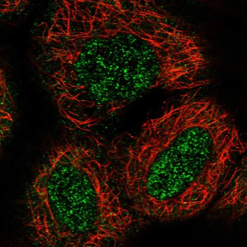 Staining of human cell line A-431 shows localization to nucleoplasm & cytosol.