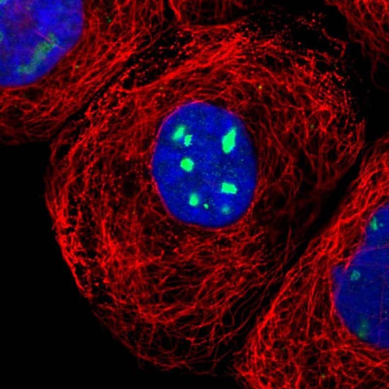 Immunocytochemistry/ Immunofluorescence RRP1 Antibody - BSA Free