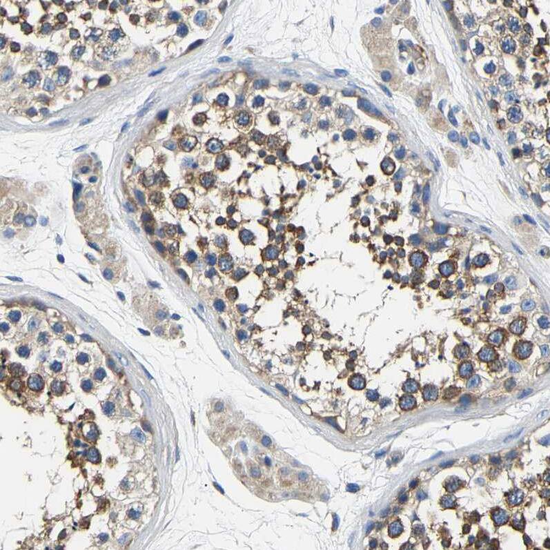 Immunohistochemistry-Paraffin CSDE1 Antibody - BSA Free