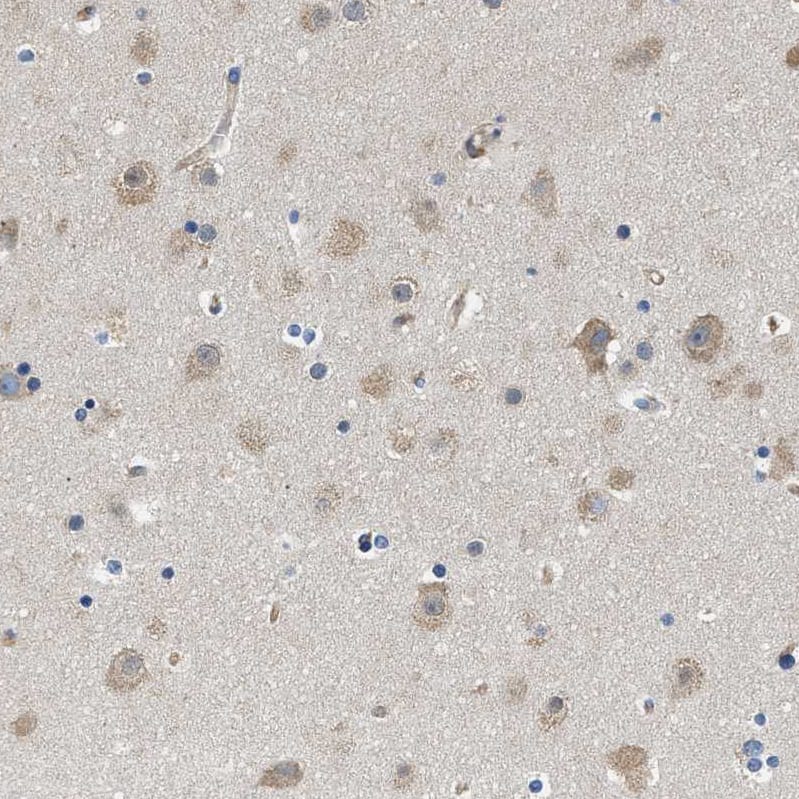 Staining of human cerebral cortex shows moderate cytoplasmic positivity in neurons.