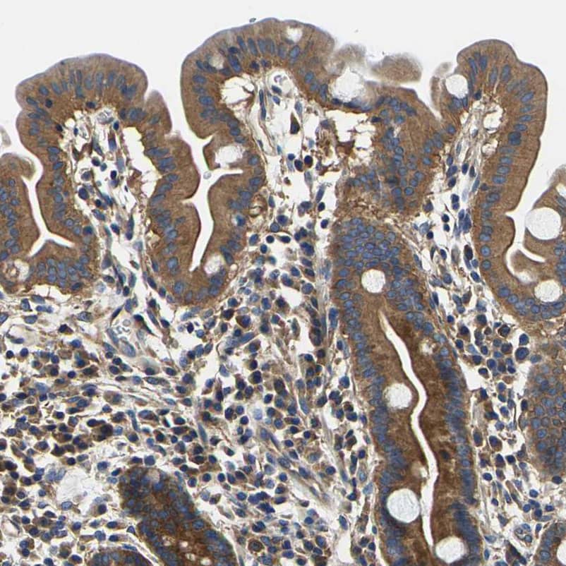 Staining of human duodenum shows moderate cytoplasmic positivity in glandular cells.