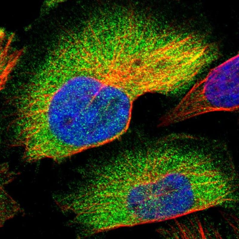 Staining of human cell line U-251 MG shows localization to cytosol.