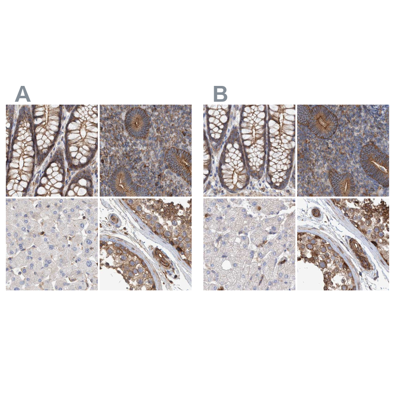 Immunohistochemistry-Paraffin NSP 5 alpha 3 alpha Antibody - BSA Free