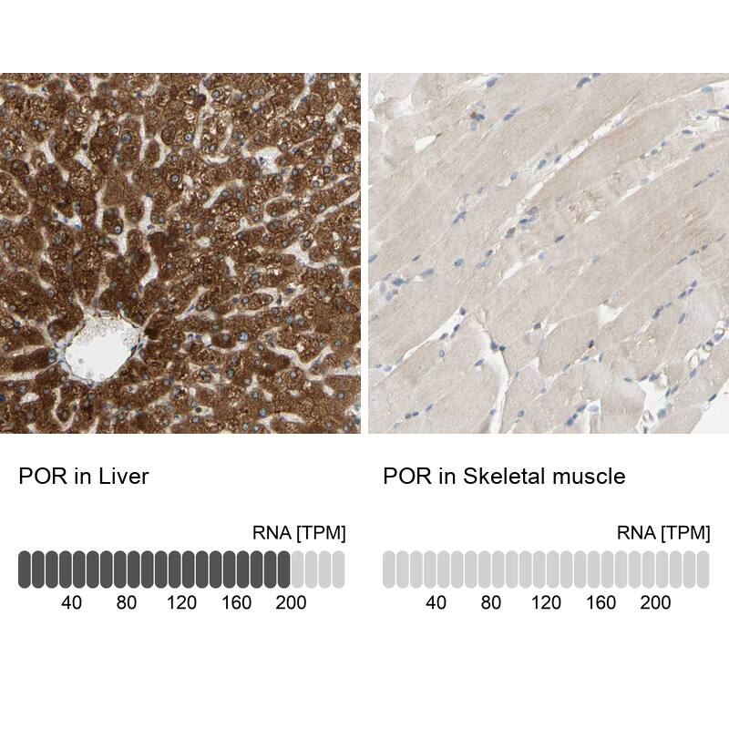 Analysis in human liver and skeletal muscle tissues. Corresponding RNA-seq data are presented for the same tissues.