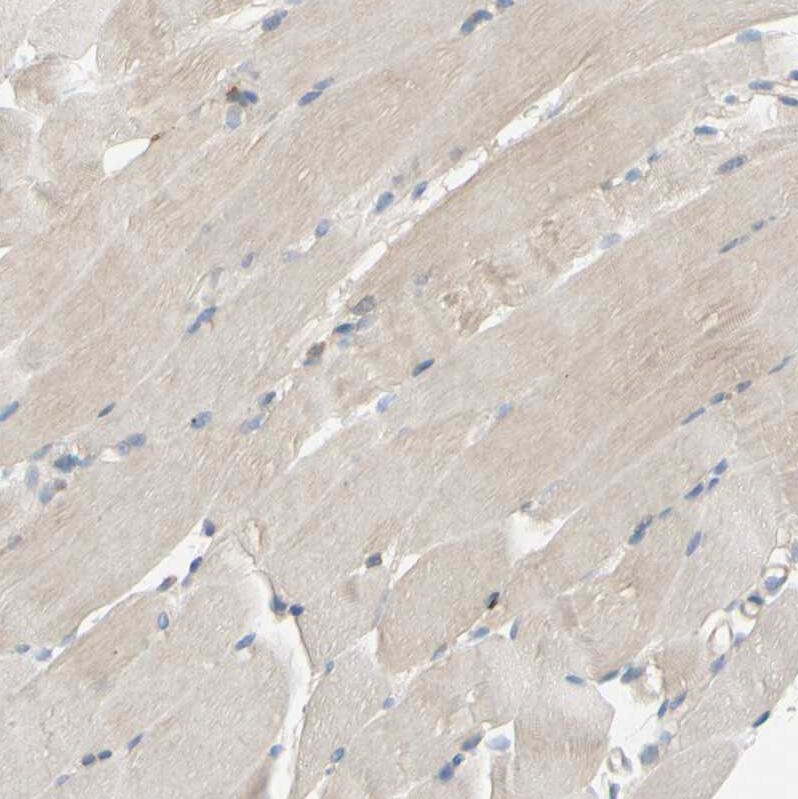 Staining of human skeletal muscle shows very weak cytoplasmic positivity in myocytes as expected.