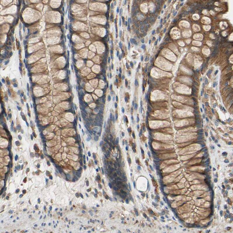 Staining of human colon shows strong cytoplasmic positivity in glandular cells.