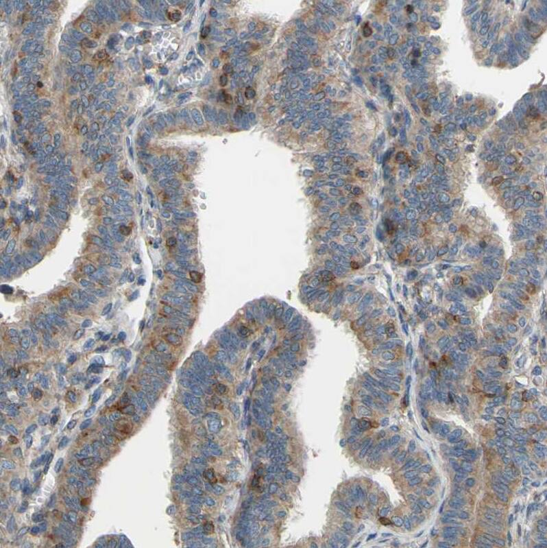 Staining of human fallopian tube shows moderate cytoplasmic positivity in glandular cells.