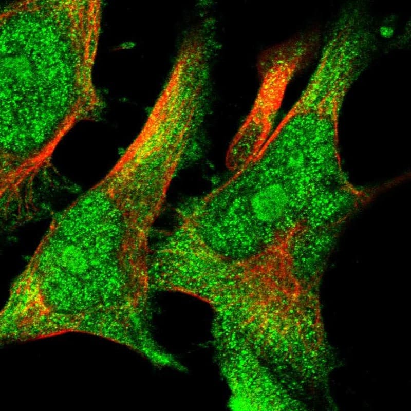 Staining of human cell line U-251 MG shows localization to nucleus, nucleoli & cytosol.