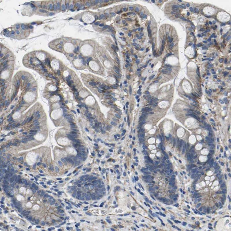 Staining of human small intestine shows cytoplasmic and membranous positivity in glandular cells.