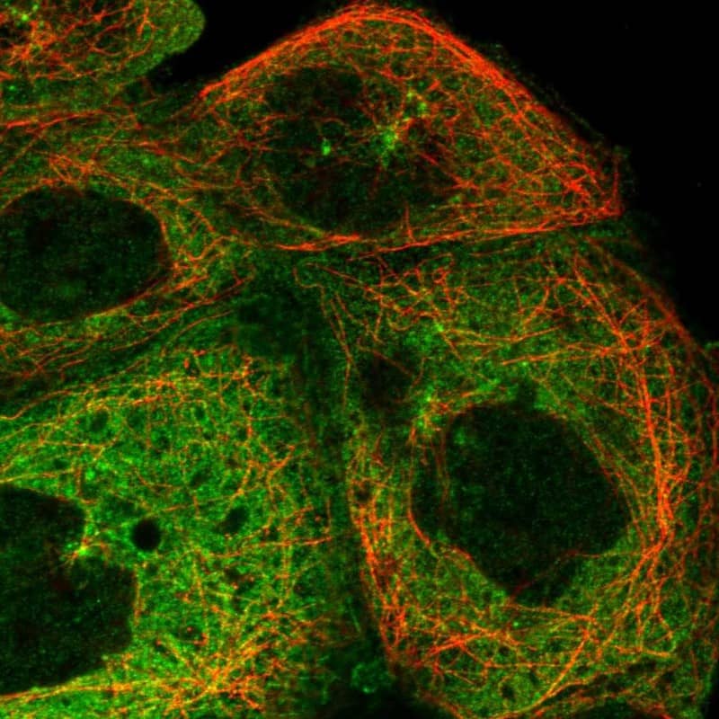 Staining of human cell line A-431 shows localization to cytosol & microtubule organizing center.