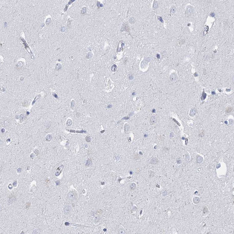 Immunohistochemistry-Paraffin HORMAD1 Antibody - BSA Free