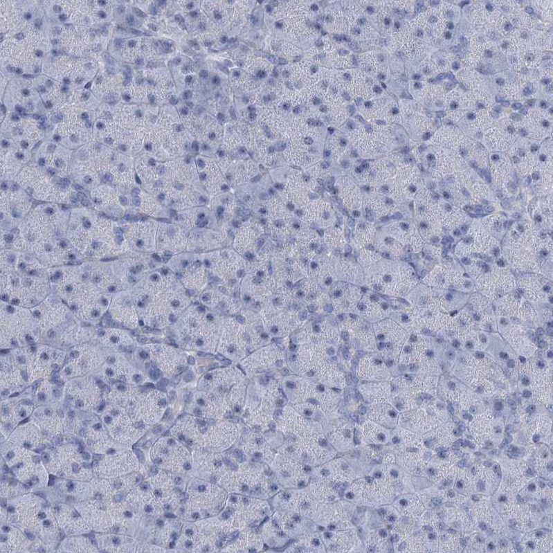 Immunohistochemistry-Paraffin HORMAD1 Antibody - BSA Free