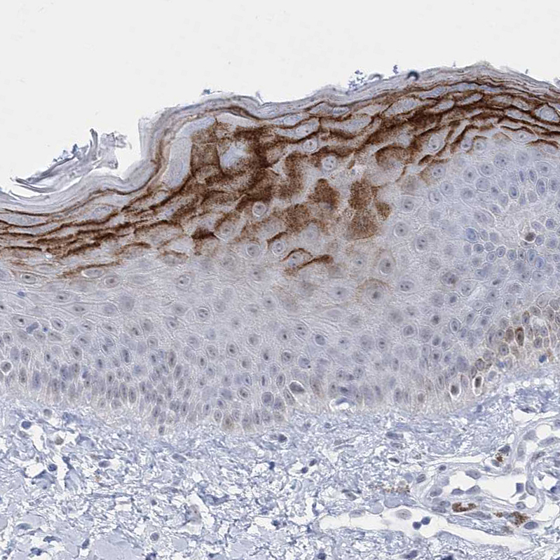 Immunohistochemistry-Paraffin HORMAD1 Antibody - BSA Free