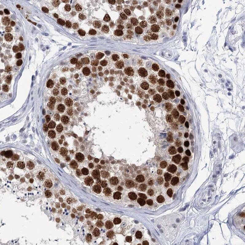 Staining of human testis shows strong nuclear positivity in cells in seminiferous ducts.