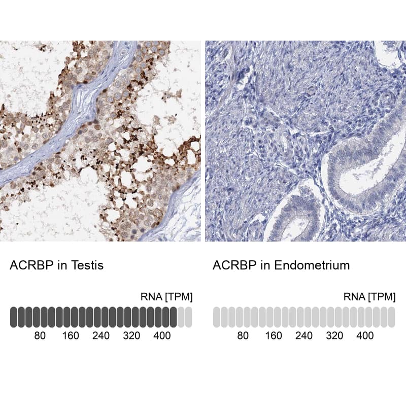 <b>Orthogonal Strategies Validation. </b>Analysis in human testis and endometrium tissues.