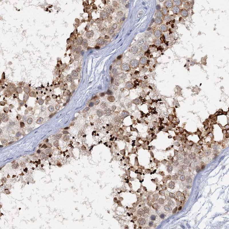 Staining of human testis shows high expression.
