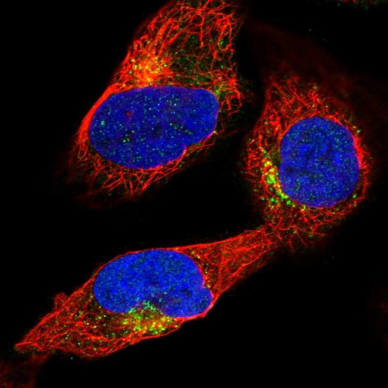 Staining of human cell line U-2 OS shows localization to vesicles.