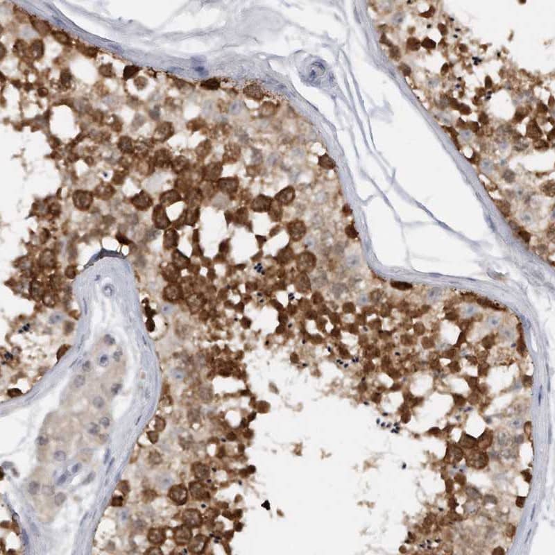 Staining of human testis shows high expression.