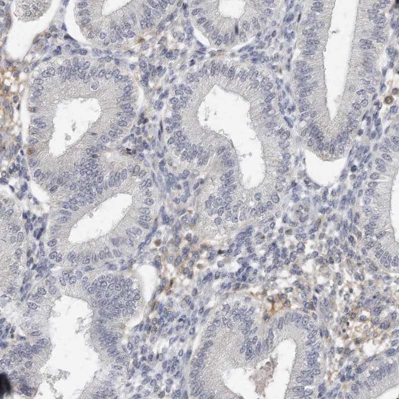 Staining of human endometrium shows low expression as expected.