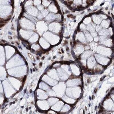 Immunohistochemistry-Paraffin CSTF3 Antibody - BSA Free