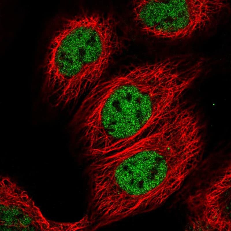Staining of human cell line A-431 shows localization to nucleoplasm.