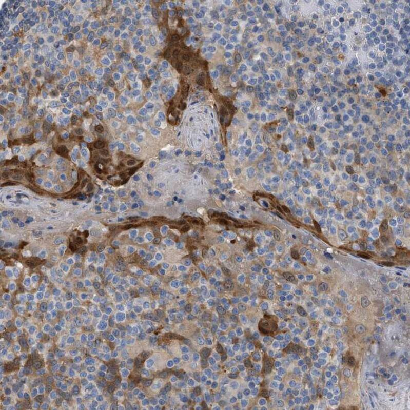 Immunohistochemistry-Paraffin Cystatin B/Stefin B Antibody - BSA Free