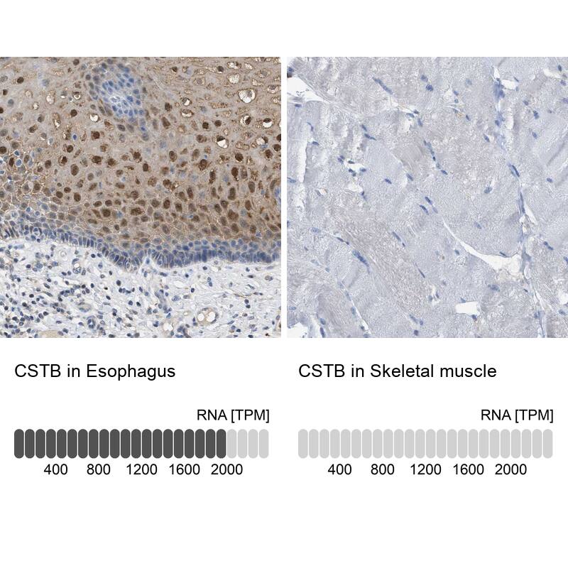Immunohistochemistry-Paraffin Cystatin B/Stefin B Antibody - BSA Free