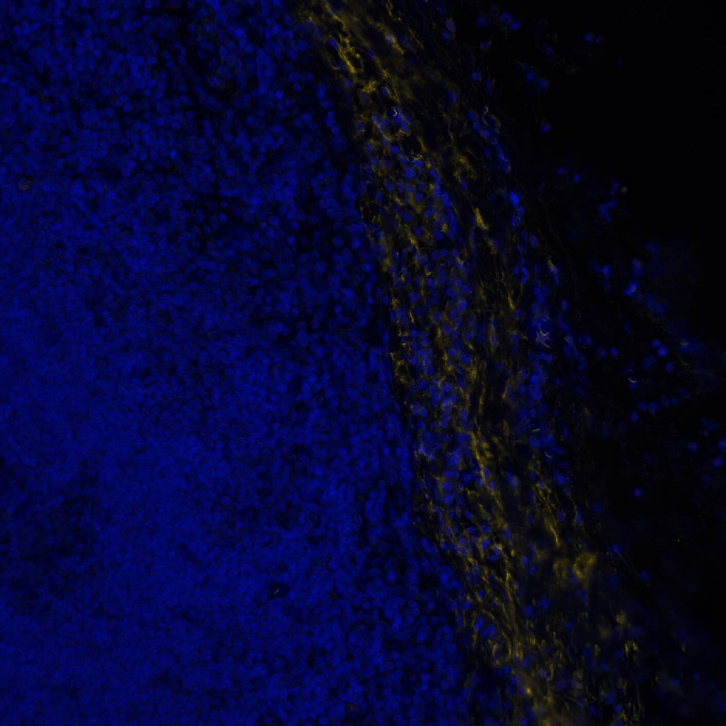 Versican was detected in immersion fixed paraffin-embedded sections of human Lymph Node using Rabbit Anti-Human/Mouse Versican, Polyclonal Antibody (Catalog # NBP1-85432) at 10ug/mL at 37° Celsius for 8 minutes. Before incubation with the primary antibody, tissue underwent an all-in-one dewaxing and antigen retrieval preprocessing using PreTreatment Module (PT Module) and Dewax and HIER Buffer H (pH 9; Epredia Catalog # TA-999-DHBH). Tissue was stained using the Alexa Fluor™ Plus 555 Goat anti-Rabbit IgG Secondary Antibody at 1:100 at 37 ° Celsius for 2 minutes. (Yellow; Lunaphore Catalog # <A class=