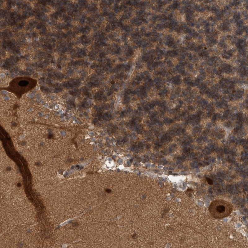 Staining of human cerebellum shows strong nuclear positivity in purkinjee cells.