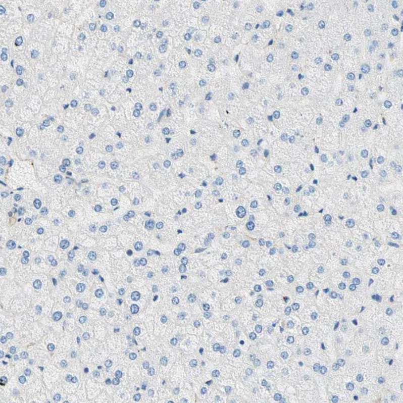 Staining of human liver shows no positivity in hepatocytes as expected.