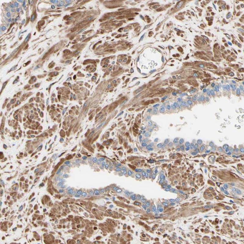 Staining of human prostate shows moderate cytoplasmic positivity in smooth muscle cells.