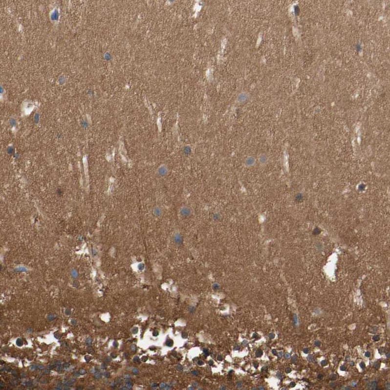 Staining of human cerebellum shows strong cytoplasmic positivity in cells in molecular layer.