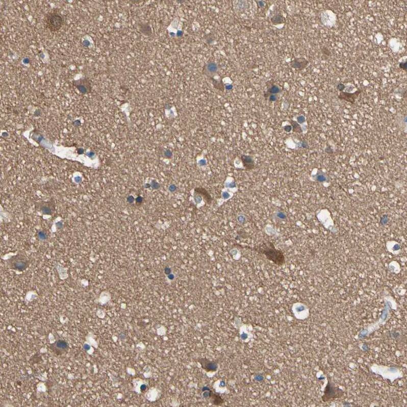 Staining of human cerebral cortex shows moderate  cytoplasmic positivity in neuropil.