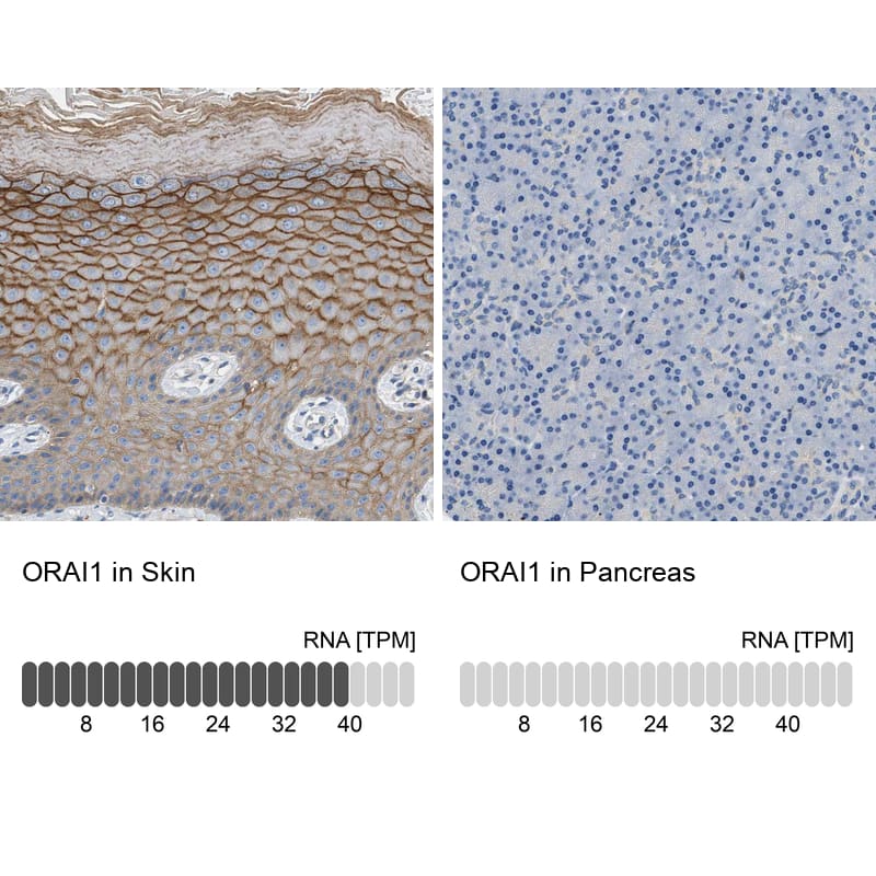 Immunohistochemistry-Paraffin Orai1 Antibody - BSA Free