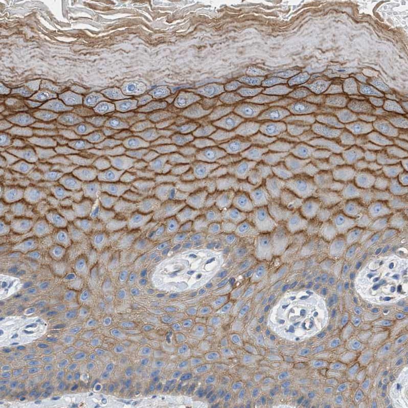 Immunohistochemistry-Paraffin Orai1 Antibody - BSA Free