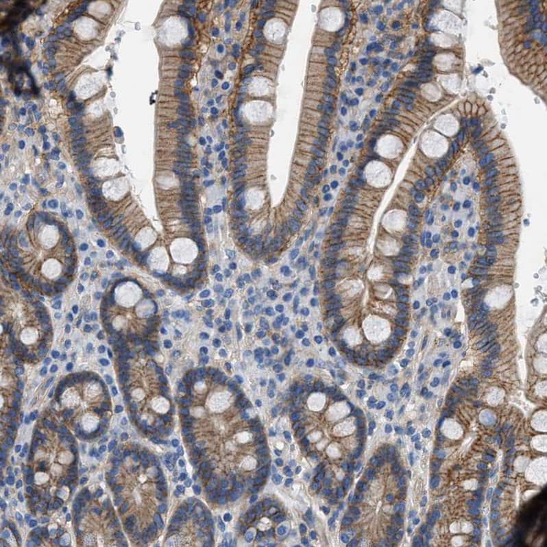 Immunohistochemistry-Paraffin Orai1 Antibody - BSA Free
