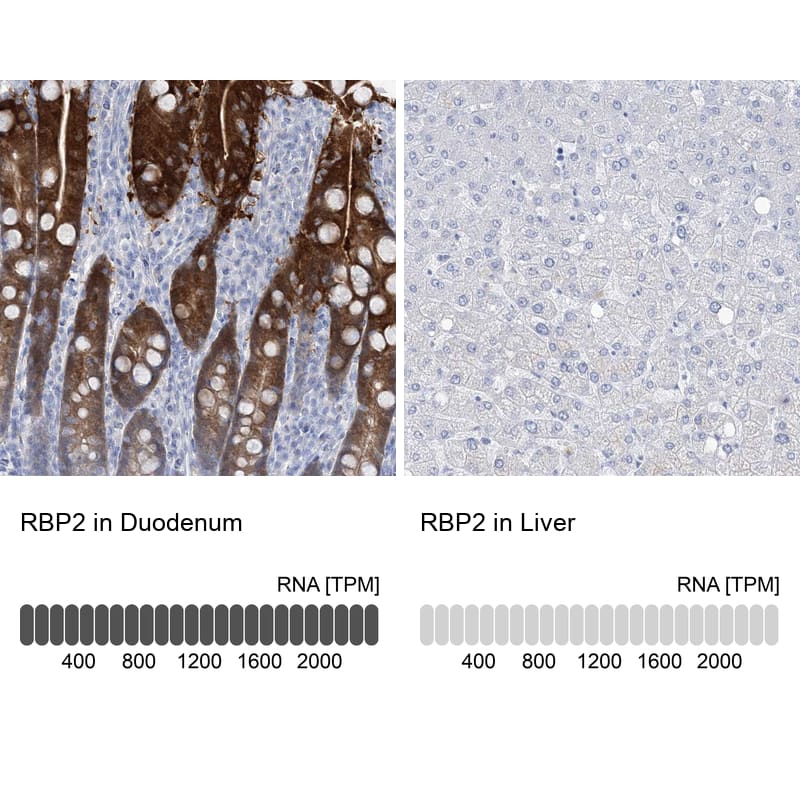 Analysis in human duodenum and liver tissues. Corresponding RNA-seq data are presented for the same tissues.
