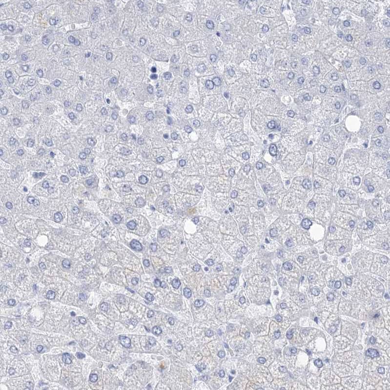 Staining of human liver shows no positivity in hepatocytes as expected.