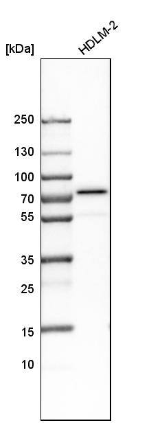 Analysis in human cell line HDLM-2.