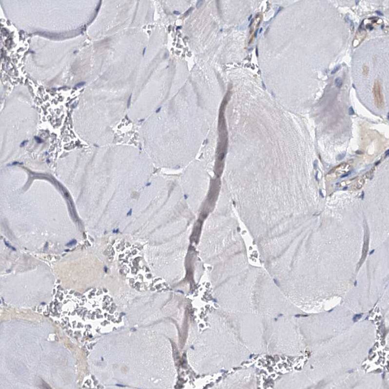 Staining of human skeletal muscle shows no cytoplasmic positivity in myocytes as expected.