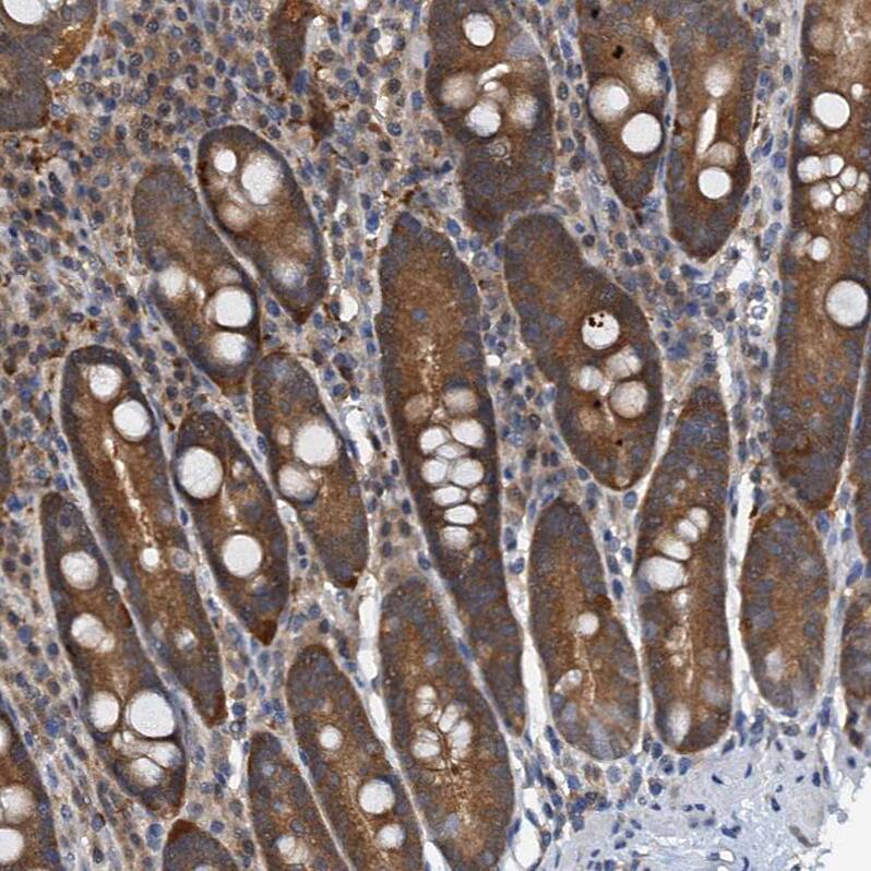 Staining of human duodenum shows moderate nuclear and cytoplasmic positivity in glandular cells.