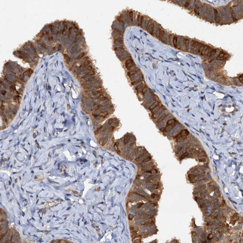Staining of human fallopian tube shows strong nuclear and cytoplasmic positivity in glandular cells.