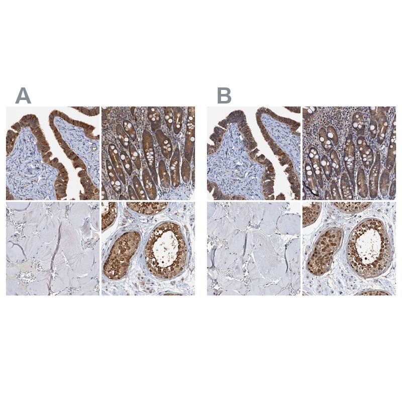 <b>Orthogonal Strategies Validation. </b>Staining of human fallopian tube, gastrointestinal, skeletal muscle and testis HPA038673 (A) shows similar protein distribution across tissues to independent antibody HPA038672 (B).