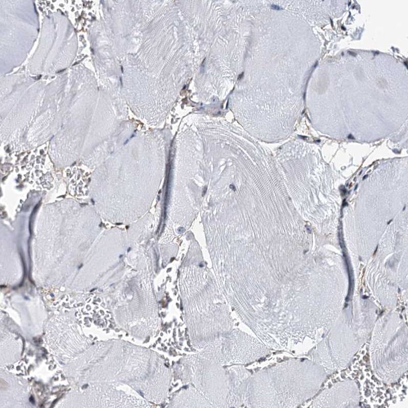Staining of human skeletal muscle shows no cytoplasmic positivity in myocytes as expected.