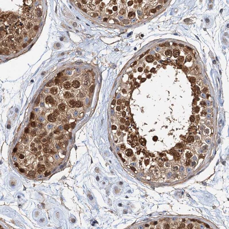 Staining of human testis shows strong nuclear and cytoplasmic positivity in cells in seminiferous ducts.