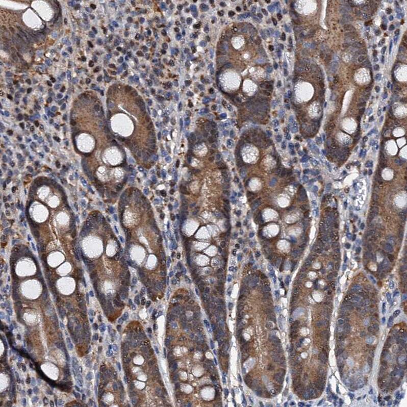 Staining of human duodenum shows moderate nuclear and cytoplasmic positivity in glandular cells.